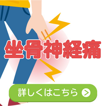 坐骨神経痛詳細ページへ移動する